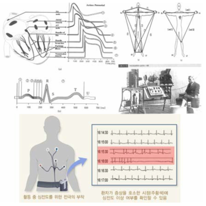 심전도 기초 자료 조사 내용