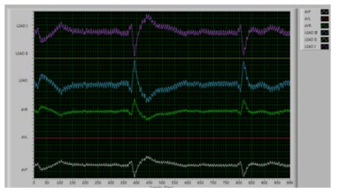 3리드 심전도 시뮬레이터 파형 측정 결과(데모키트)