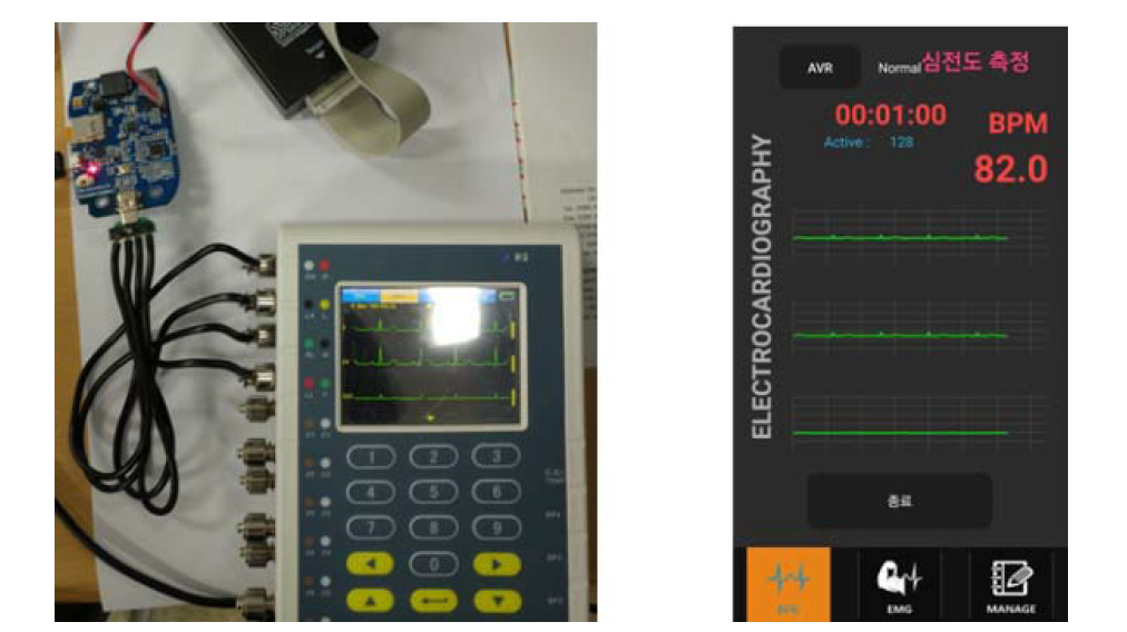 심전도 그래프 모니터링(안드로이드 어플리케이션)
