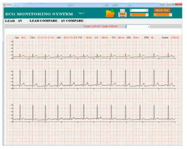 심전도 그래프 모니터링(윈도우용 어플리케이션)