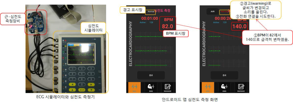 심전도 시험 결과 화면