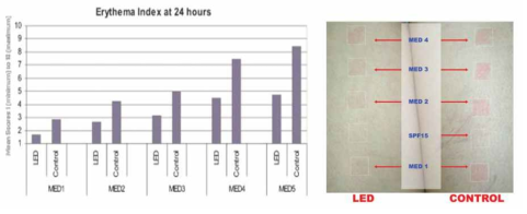 LED 전조사 후 UV 조사를 통해 일어나는 홍반 스코어 확인