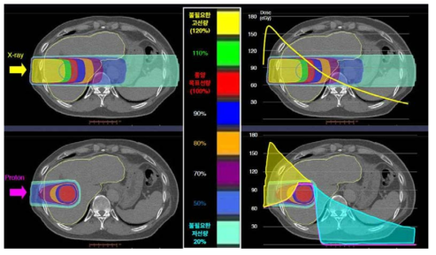 X-ray와 Proton의 인체투과시 방사선량 비교