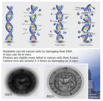 양성자와 중입자 치료법의 비교