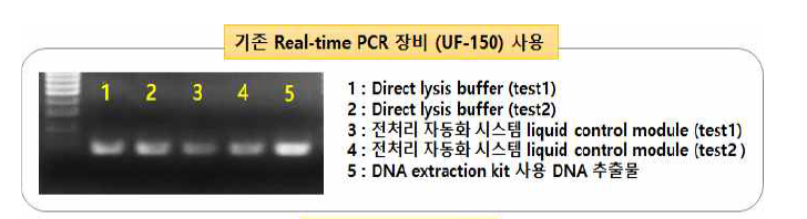 다양한 전처리 방법에 의한 기존 장비의(UF-150) 전기영동 사진