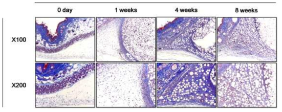 G4 주입 후, 시간에 따른 collagen fiber 형성 확인 - MT staining (X100, X200)