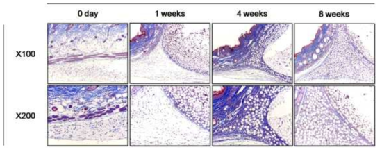 G5 주입 후, 시간에 따른 collagen fiber 형성 확인 - MT staining (X100, X200)