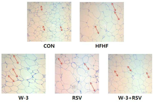 로수바스타틴, 오메가-3 단독군 및 복합처리군의 H&E 염색을 통한 지방조직의 크기 측정
