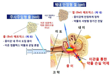 중이염 치료제로의 응용