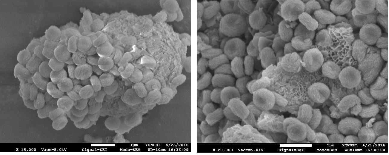 BALA를 첨가제로 사용한 경우 생성된 금속탄산염의 SEM image