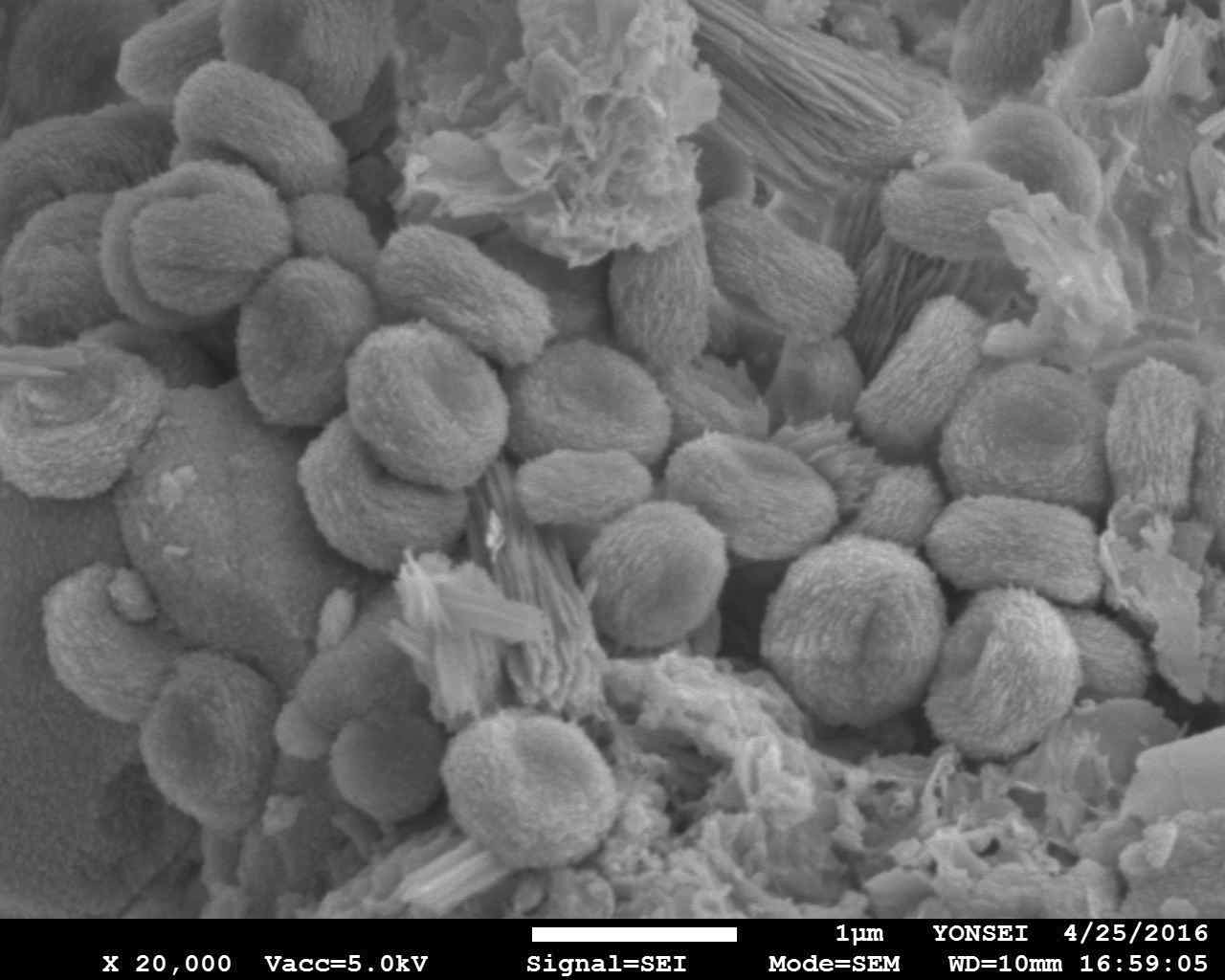NH4Cl를 첨가제로 사용한 경우 생성된 금속탄산염의 SEM image
