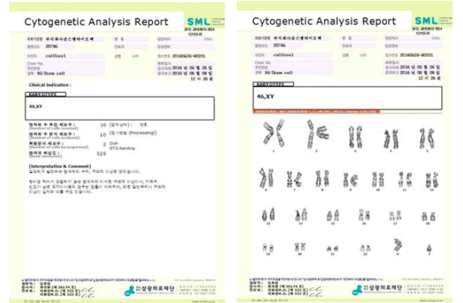 염색체변이 분석 결과1 (KS-R-44-3G1-N)
