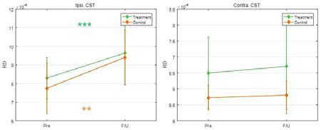 CST의 병변측, 건측의 RD 변화