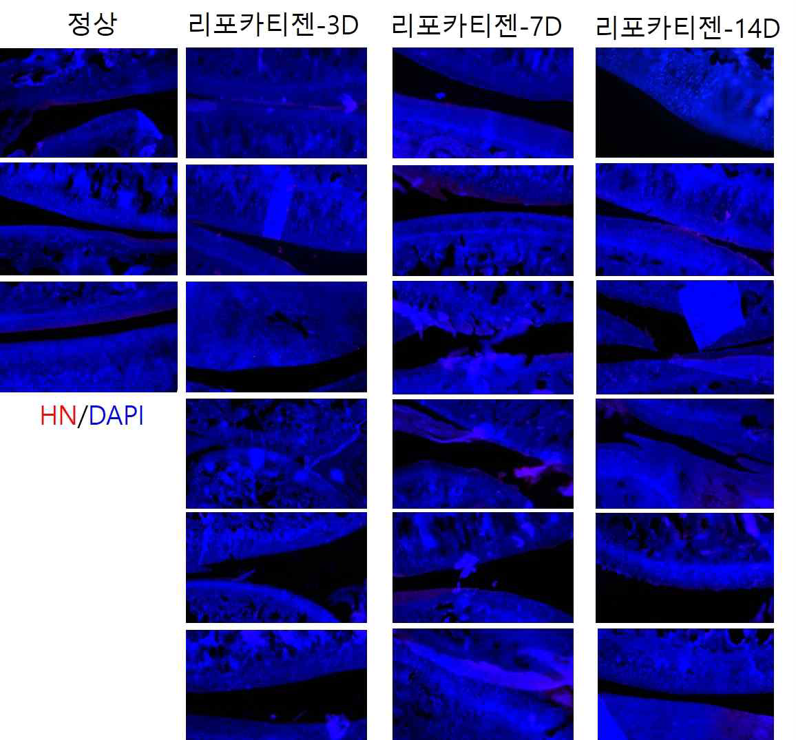 SD rat 골관절염 동물 모델에서 SOX9-6 이입 지방줄기세포의 MoA 확인을 위한 사람특이적 마커(HN)의 면연화학염색 사진