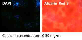 생분해성 하이드로젤 기반 나노/마이크로 섬유 내에서 골 분화 14일 경과 후 Alizarin Red S 염색 및 칼슘 농도 측정 결과