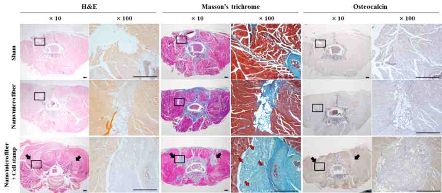 이식된 부위의 H&E, Masson’s trichrome 염색 및 Osteocalcin 발현 결과