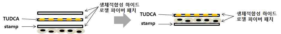 스탬프된 줄기세포내 약물(TUDCA) 전달 시스템