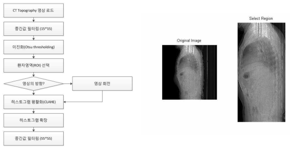 CT topography 영상의 전처리 과정 및 신체 영역의 자동 분할 결과의 예