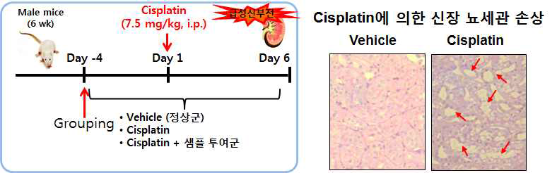 Cisplatin의 처리에 신장 세포 손상