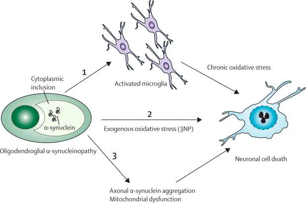 alpha-synuclein 의 축적에 의한 신경세포의 사멸