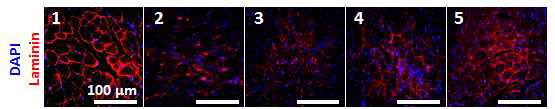 세포와 세포시트조각이 이식된 전경골의 라미닌에 대한 형광 면역염색