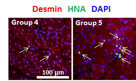 세포와 세포시트조각이 이식된 28일차 전경골의 desmin과 HNA에 대한 이중 면역염색. 이식된 인간제대혈줄기세포가 골격근을 재생함을 보여줌.