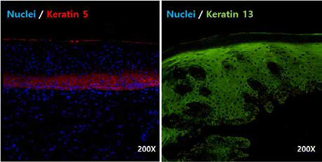 면역염색법을 이용하여 keratin 5 (왼 쪽)와 keratin 13 (오른쪽)이 염색된 정상 구강 점막