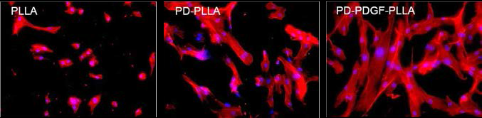 형광 염색을 통해 확인한 PLLA, PD-PLLA, PD-PDGF-PLLA 상에서의 세포 부착 형태