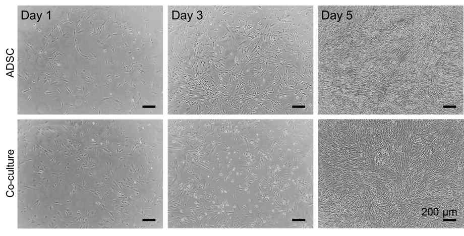 MesenPRO RS와 EGM-2 혼합 배지를 이용한 ADSC, HUVEC 공배양 조건 확인
