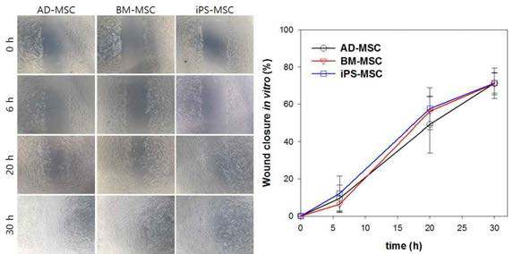 다양한 줄기세포에 의한 wound closure in vitro