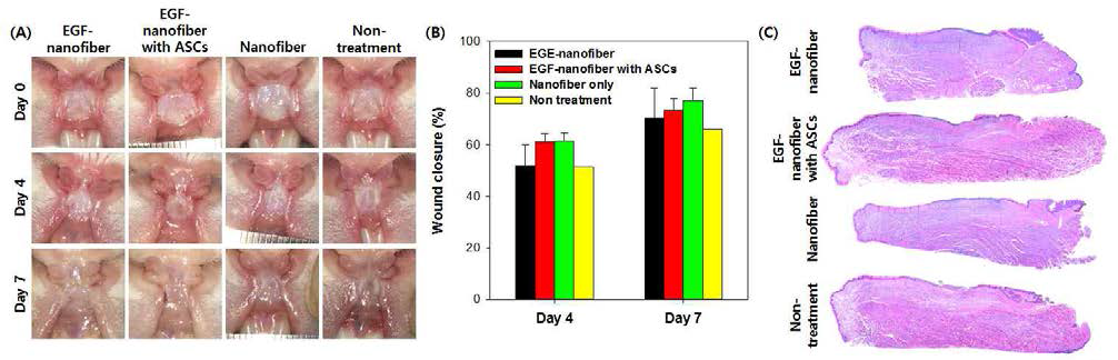 성장인자가 도입된 나노섬유지지체-줄기세포 복합체를 이용한 중증 구강 궤양 치료 효능 평가
