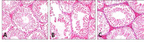 The Results of Masson trichrome stain in mouse testis(×100). A, Control group; B, Aging-elicited group; C, Gami-Shinkiwhan group