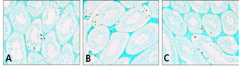 The Results of TUNEL assay in mouse testis(×400). A, Control group; B, Aging-elicited group; C, Gami-Shinkiwhan group