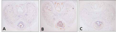 Immunohistochemistry of PDE5 in Penis(×100). A, Control group ; B, PE group ; C, Gami-Shinkiwhan group