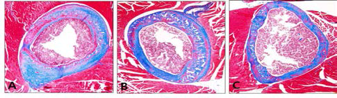 Changes in spongy in the femur(×100). A, Control group; B, Aging-elicited group; C, Gami-Shinkiwhan group