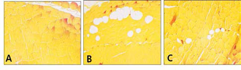 Changes in fat deposition in quadriceps muscle. A, Control group; B, Aging-elicited group; C, Gami-Shinkiwhan group