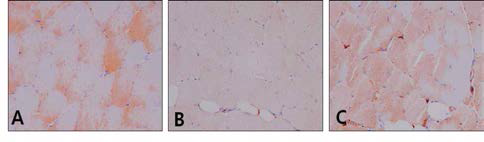 Immunohistochemistry of SOD-1 positive reaction in quadriceps muscle. A, Control group; B, Aging-elicited group; C, Gami-Shinkiwhan group