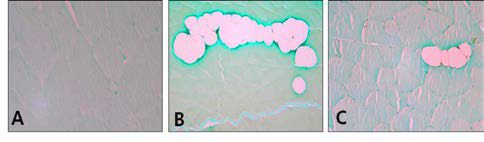 The Results of TUNEL assay in quadriceps muscle.(×400). A, Control group; B, Aging-elicited group; C, Gami-Shinkiwhan group