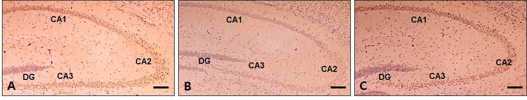 Changes of serotonin in the hippocampus. DG : Dentate gyrus; bar size, 100 ㎛. A, Control group; B, Depression group; C, Gami-Shinkiwhan group