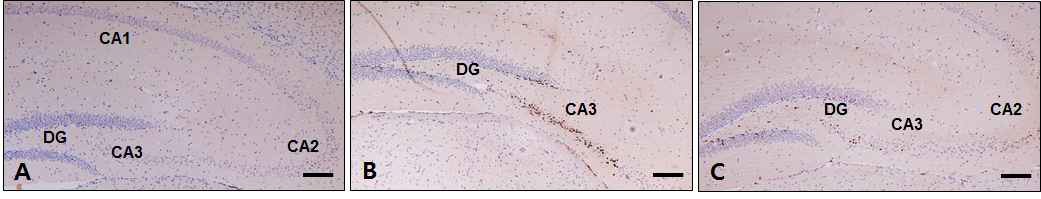 Changes of caspase-3 in the hippocampus. DG : Dentate gyrus; bar size, 100 ㎛. A, Control group; B, Depression group; C, Gami-Shinkiwhan group