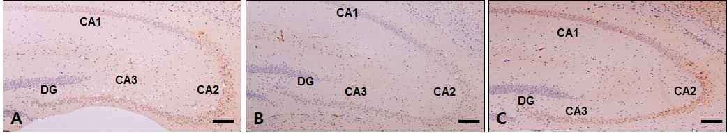 Changes of SHH in the hippocampus. DG : Dentate gyrus; bar size, 100 ㎛.A, Control group; B, Depression group; C, Gami-Shinkiwhan group