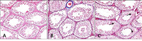 The Results of Masson trichrome stain in mouse testis(×100). A,Control group; B, Aging-elicited group; C, Gami-Shinkiwhan group