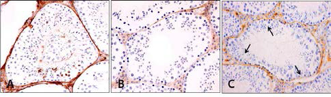 The Results of BrdU stain in mouse testis(×400). A, Control group; B, Aging-elicited group; C, Gami-Shinkiwhan group