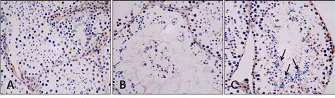 Immunohistochemistry of AR in mouse testis(×400). A, Control group; B, Aging-elicited group; C, Gami-Shinkiwhan group