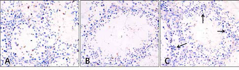 Immunohistochemistry of DJ-1 in mouse testis(×400). A, Control group; B, Aging-elicited group; C, Gami-Shinkiwhan group