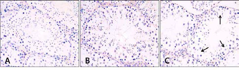 Immunohistochemistry of HDAC3 in mouse testis(×400). A, Control group; B, Aging-elicited group; C, Gami-Shinkiwhan group