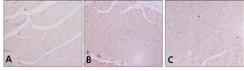 Immunohistochemistry of caspase-3 in quadriceps muscle.(×400). A, Control group; B, Aging-elicited group; C, Gami-Shinkiwhan group