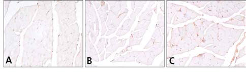 Immunohistochemistry of MyoD in quadriceps muscle.(×400). A, Control group; B, Aging-elicited group; C, Gami-Shinkiwhan group