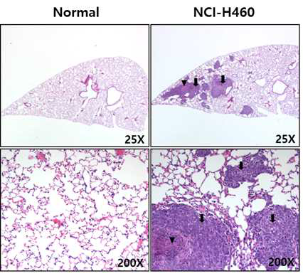 I.V. injection 에 의한 폐암 동물 모델의 폐 조직 분석