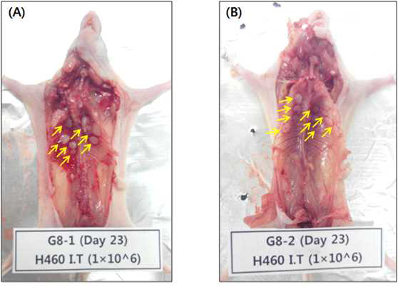 H460 폐암 세포의 I.T. injection 을 통한 폐암 동물 모델의 종양 전이 관측